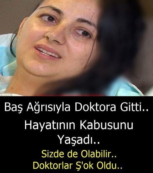 Sürekli Baş a'ğrısı çekiyordu.. galerisi resim 1