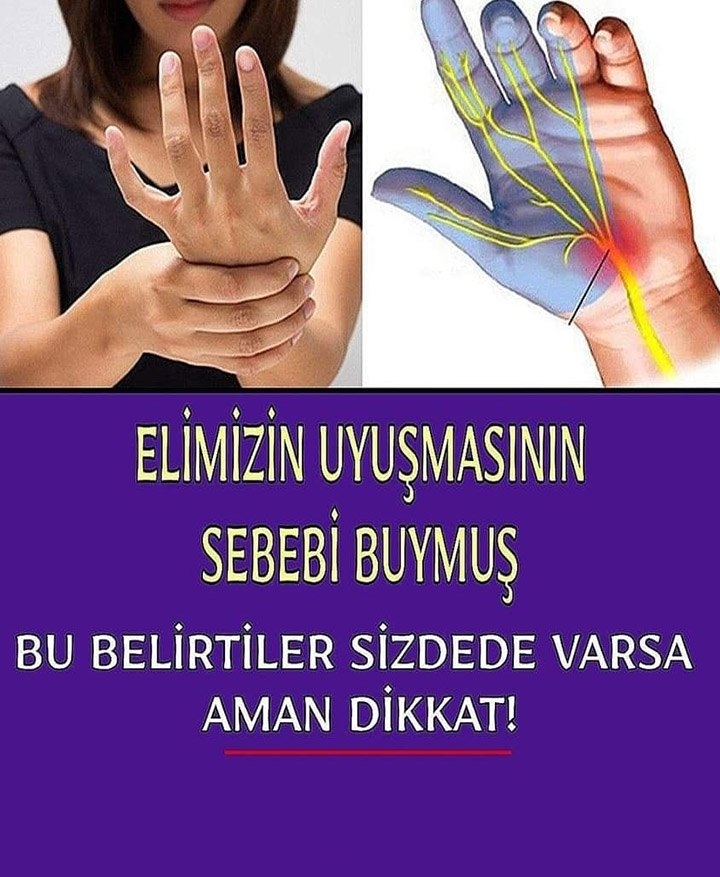 El Uyuşmasının Asıl Sebebii Buymuş.. galerisi resim 3