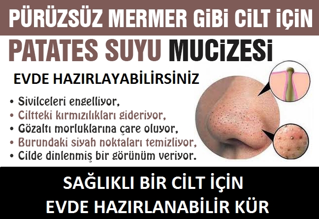 Mermer Gibi Pürüzsüz Bir Cilt İster Miydiniz? galerisi resim 2