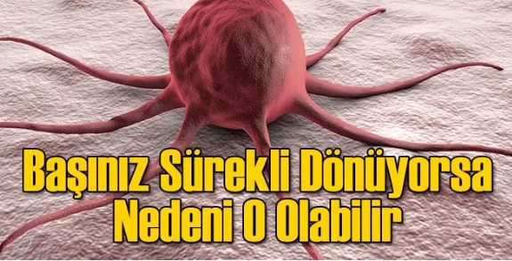 Sürekli Başınız Dönüyorsa galerisi resim 2