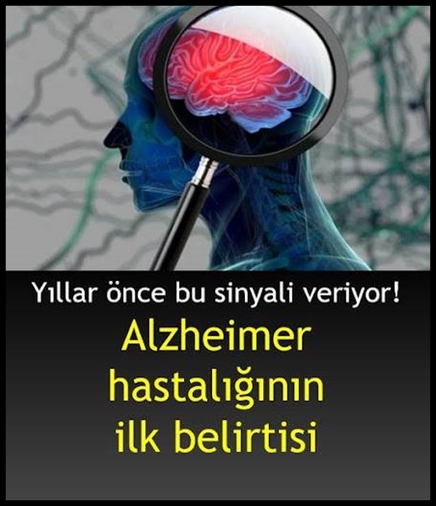 Alzheimer hastalığının ilk belirtisi galerisi resim 1