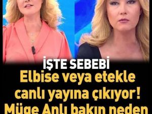 Neden sürekli elbise giyiyor?