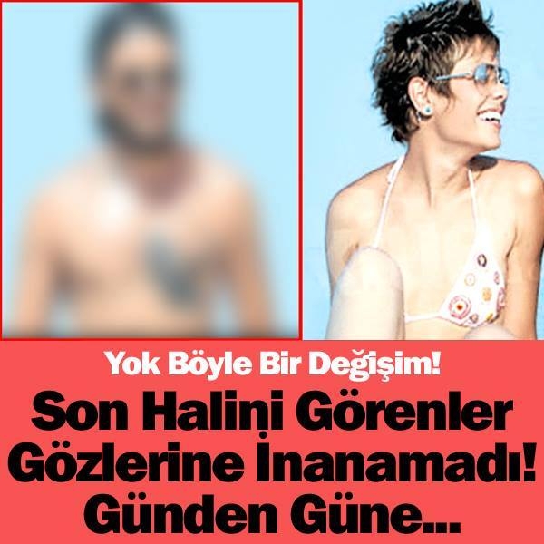 Son Halini Görenler Gözlerine İnanamadı! Günden Güne... galerisi resim 1