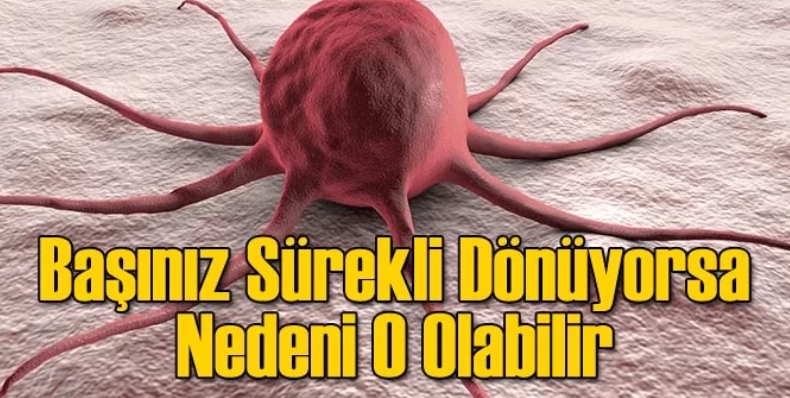 Başınız Dönüyorsa galerisi resim 2