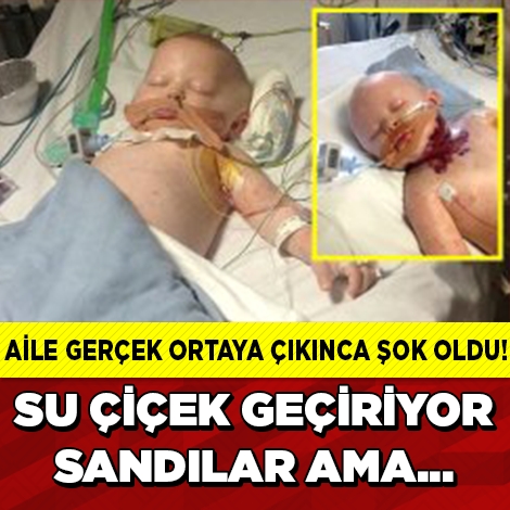 Su Çiçeği Sandılar Ama… galerisi resim 1