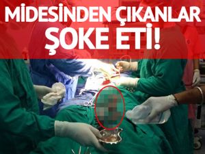 Midesinden ameliyatla 40 çakı çıkarıldı