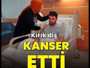 Kırık Diş Kanser Etti.