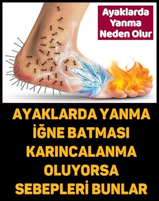 Ayaklarda Karıncalanma Oluyorsa galerisi resim 1