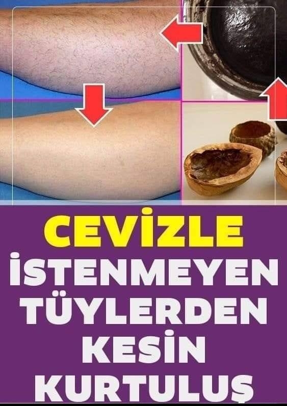 Cevizle istenmeyen tüylerden kurtulmanın kesin yolu galerisi resim 1