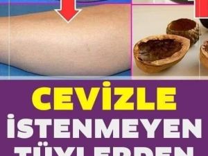 Cevizle istenmeyen tüylerden kurtulmanın kesin yolu