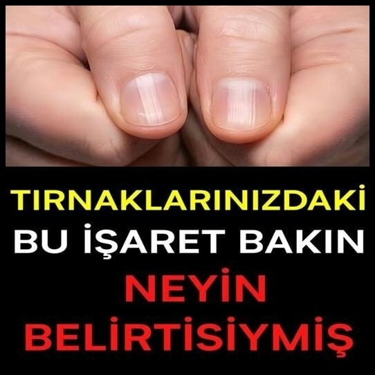 TIRNAKLARINIZDAKİ BU İŞARET BAKIN NEYİN BELİRTİSİYMİŞ galerisi resim 1