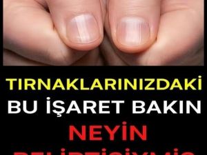 TIRNAKLARINIZDAKİ BU İŞARET BAKIN NEYİN BELİRTİSİYMİŞ