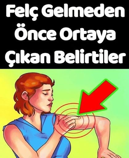 Felç geçirmeden evvel ortaya çıkan belirtiler galerisi resim 1