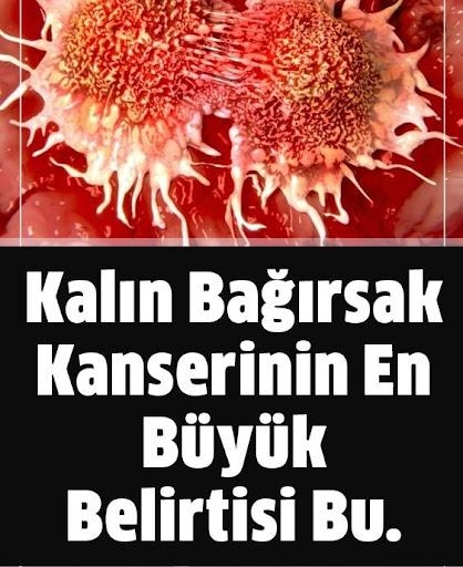 Kalın Bağırsak Kanseri Belirtileri galerisi resim 1