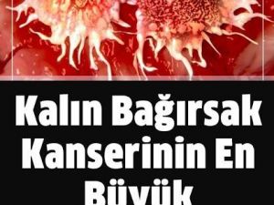 Kalın Bağırsak Kanseri Belirtileri