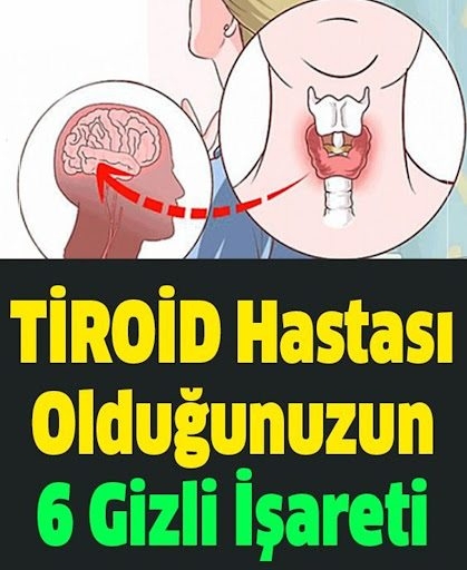 Tiroid Hastası Olduğunuzun 6 Saklı İşareti galerisi resim 1