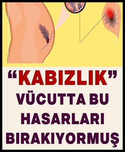 Kabızlık vücutta bu hasarları bırakıyormuş. galerisi resim 1