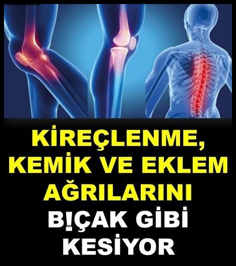 Kireçlenme ve eklem ağrılarına çare galerisi resim 1