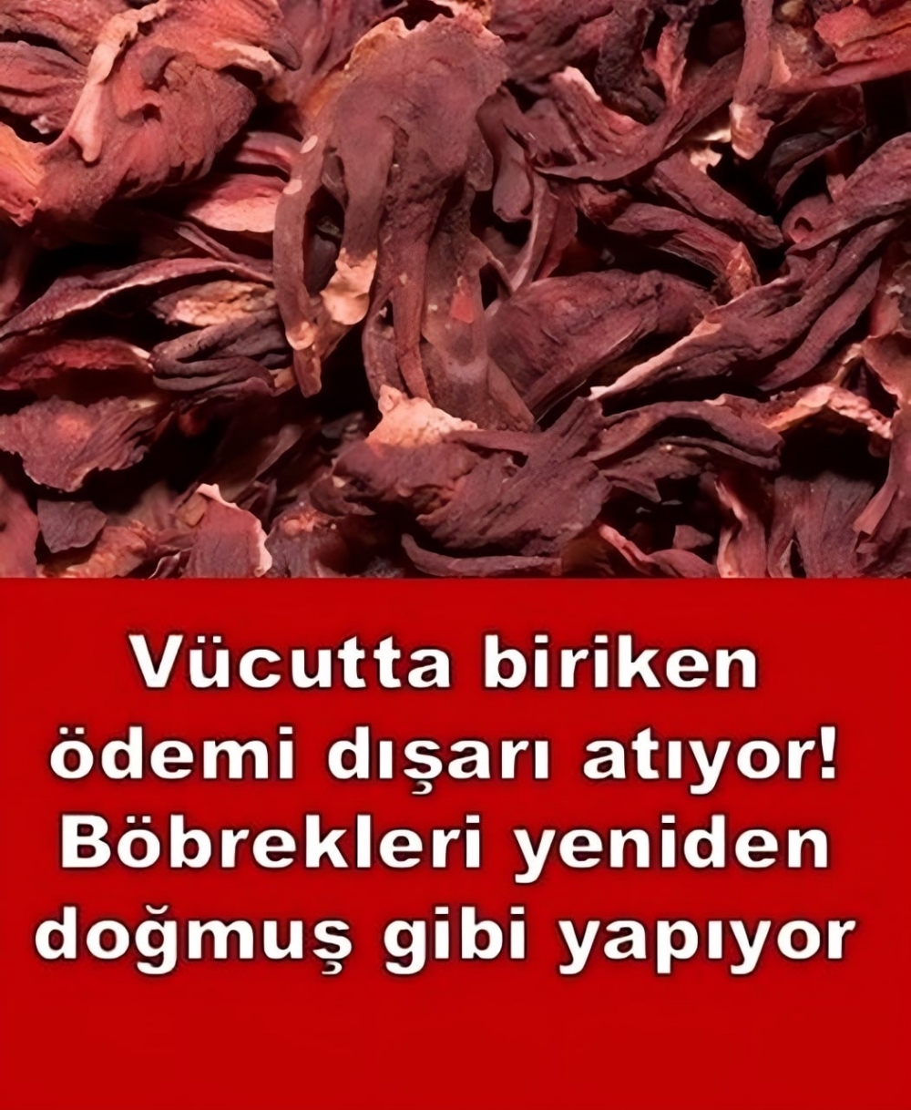 Böbrek sağlığı için önemli galerisi resim 1