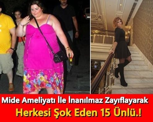 Mide Ameliyatı İle İnanılmaz Zayıflayarak Herkesi Şok Eden 15 Ünlü.! galerisi resim 1