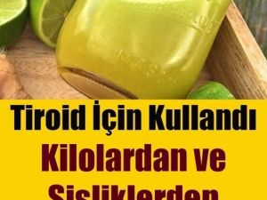 Tiroid bezi metabolizma dengesinde çok mühim bir rol oynar