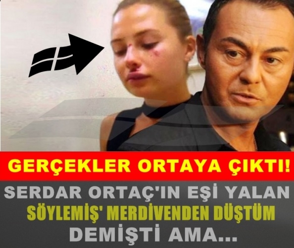 SERDAR ORTAÇ’IN EŞİ YALAN SÖYLEMİŞ! MERDİVENDEN DÜŞTÜM DEMİŞTİ AMA… galerisi resim 1