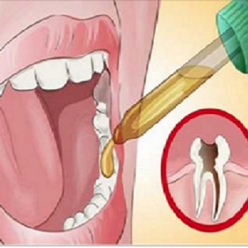 Diş ağrısından duramıyorsanız bunu mutlaka deneyin galerisi resim 5