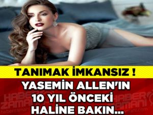 YASEMİN ALLEN'IN 10 YIL ÖNCEKİ HALİ ŞOK ETTİ!!!