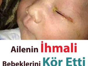 Ailenin İhmali Bebeklerini Kör Etti