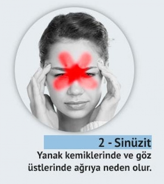 Başağrısı deyip geçmeyin sakın! Bir ağrı var ki, TÜMÖR belirtisi. galerisi resim 5