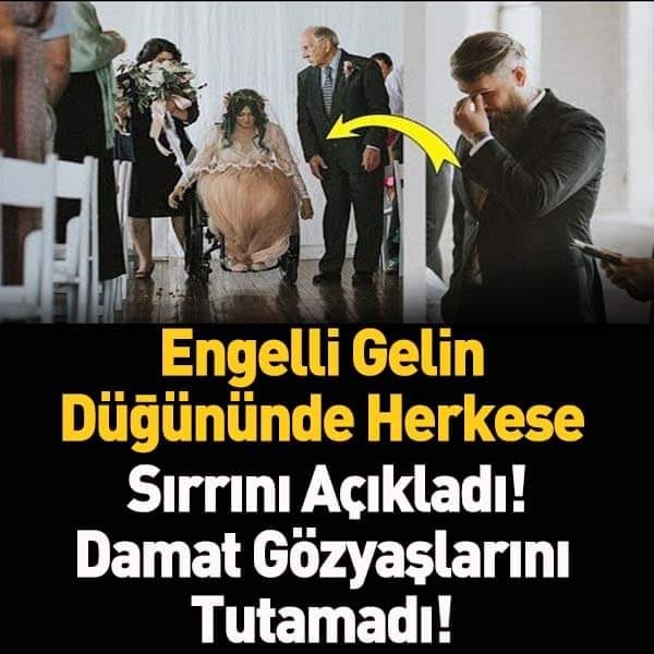 Engelli Gelin Düğününde Herkese Sırrını Açıkladı ve Damat Gözyaşlarını T galerisi resim 1