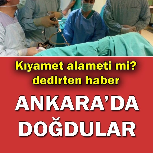 Dünyada 200 binde bir görülüyor… Ankara’da doğdular galerisi resim 1