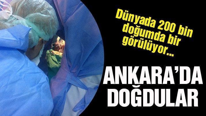 Dünyada 200 binde bir görülüyor… Ankara’da doğdular galerisi resim 2