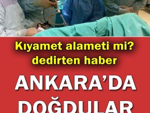 Dünyada 200 binde bir görülüyor… Ankara’da doğdular