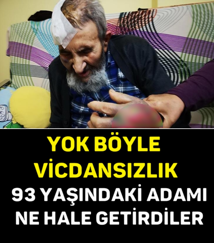 YOK BÖYLE VİCDANSIZLIK, 93 YAŞINDAKİ ADAMI NE HALE GETİRDİLER galerisi resim 1