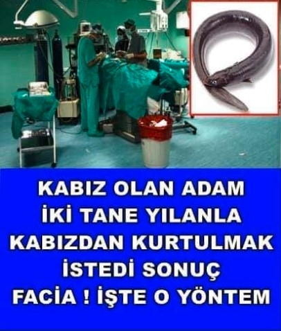 Adam Yılan Balığı Yuttu galerisi resim 1