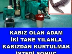 Adam Yılan Balığı Yuttu