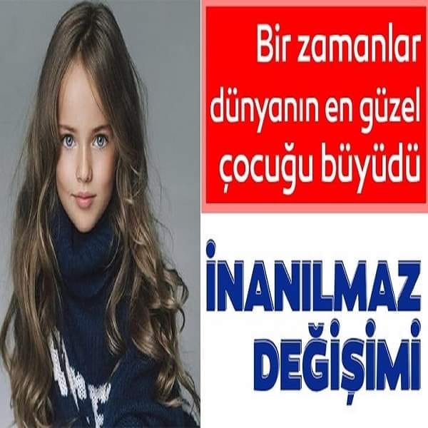 Dünyanın en güzel çocuğu büyüdü! İşte inanılmaz değişimi galerisi resim 1