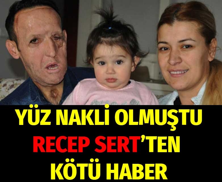 Yüz nakilli Recep Sert'ten kötü haberi eşi Esma Sert açıkladı Recep galerisi resim 1