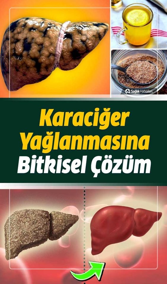 Karaciğer Yağlanmasını Temizleyen Bitkisel Öneriler galerisi resim 1