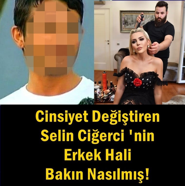 Yüzündeki o detay; galerisi resim 1