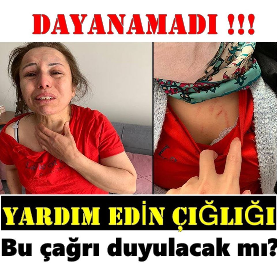 'Yardım edin, dayanacak gücüm kalmadı!' dedi. galerisi resim 3