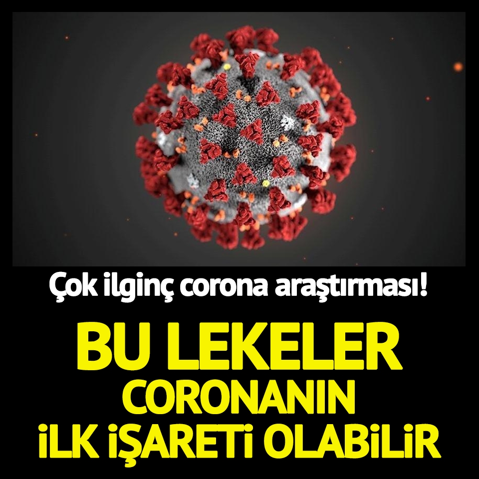 Çok İlginç Araştırma! Bu Lekeler Coronanın İlk İşareti Olabilir galerisi resim 1