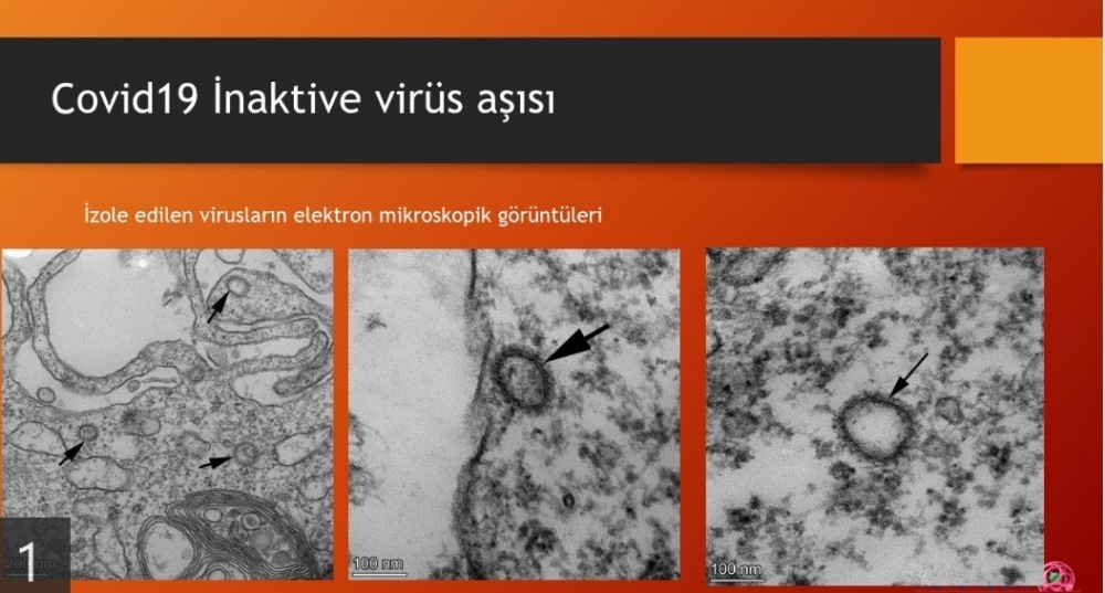 İşte Virüsü Parçalayan Aşının Görüntüsü; galerisi resim 1