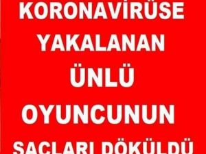 Koronaya Yakalanan Ünlü Oyuncunun Saçları Döküldü