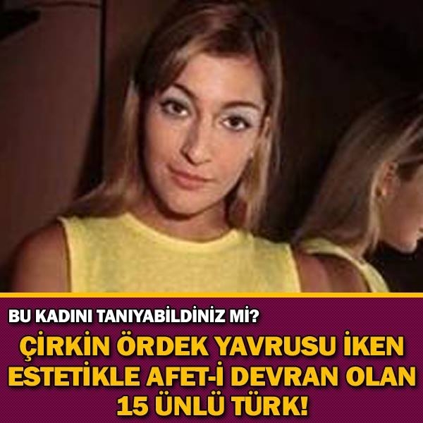 Çirkin Ördek Yavrusu İken Estetikle Afet-İ Devran Olan 15 Ünlü Türk! galerisi resim 1