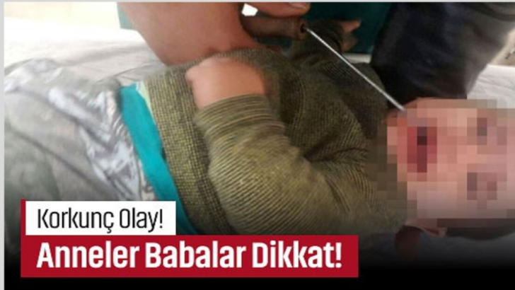 Antalya’da 9 aylık Muhammed’in başına geldi!