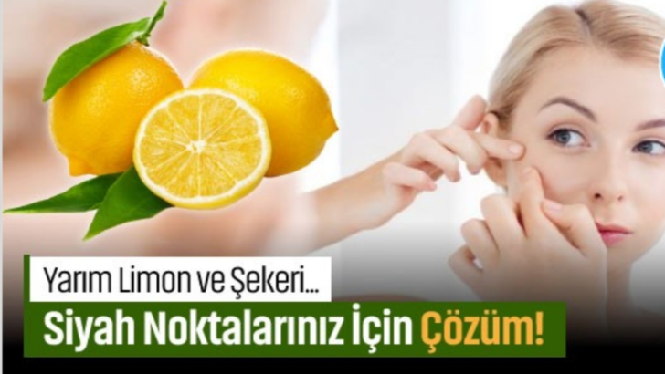 Siyah Noktalarınız İçin Çözüm! Limon ve Şeker Karışımı!