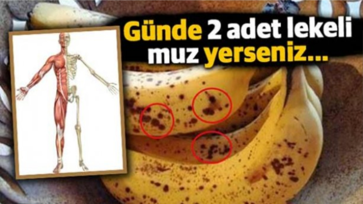 Bir ay boyunca günde iki tane lekeli muz yerseniz vücudunuzda neler değişir?