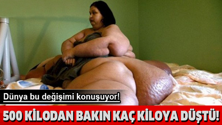 Dünya Bu KADINI Konuşuyor! 500 Kilodan BAKIN Kaç Kiloya Düştü?